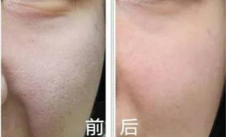 恒和白瓷娃娃—让你素颜也是“肤白貌美”！